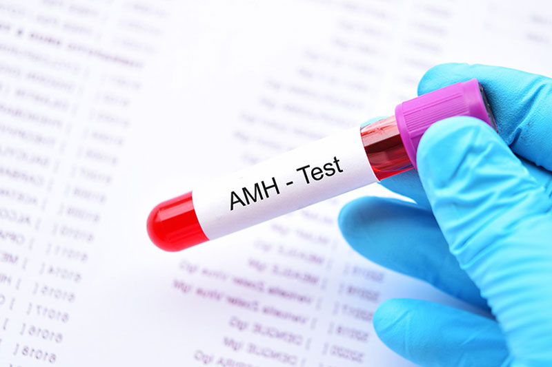 Xét nghiệm AMH hỗ trợ đánh giá khả năng sinh sản
