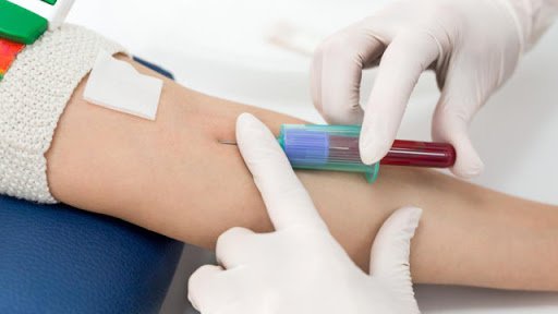 Ý nghĩa xét nghiệm lactate máu