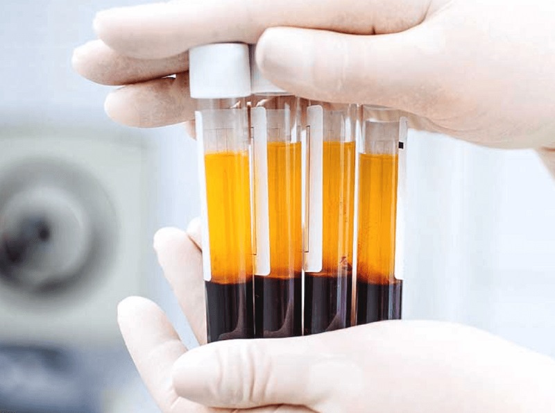 Xét nghiệm APTT được thực hiện khi nào? | Medlatec