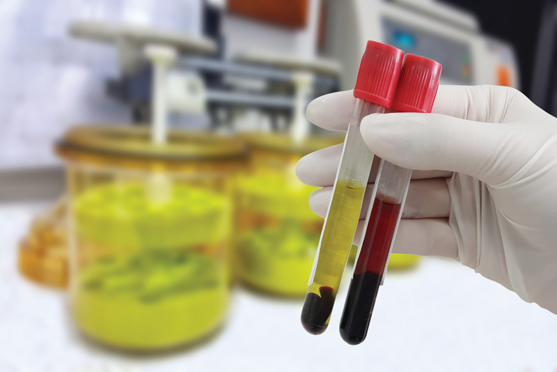 Cùng tìm hiểu các ứng dụng của huyết thanh trong y học | Medlatec