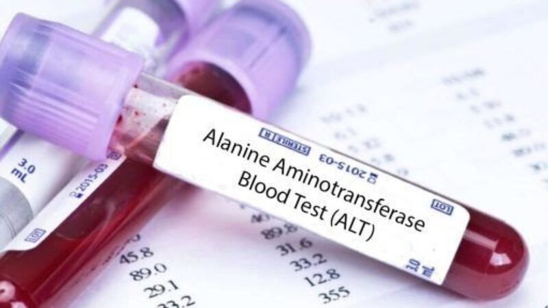 Xét nghiệm nồng độ ALT là xét nghiệm chức năng gan cơ bản