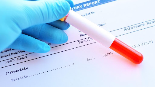 Xét nghiệm Procalcitonin (PCT) trong định hướng sử dụng kháng sinh - Công  ty TNHH Nhật Anh