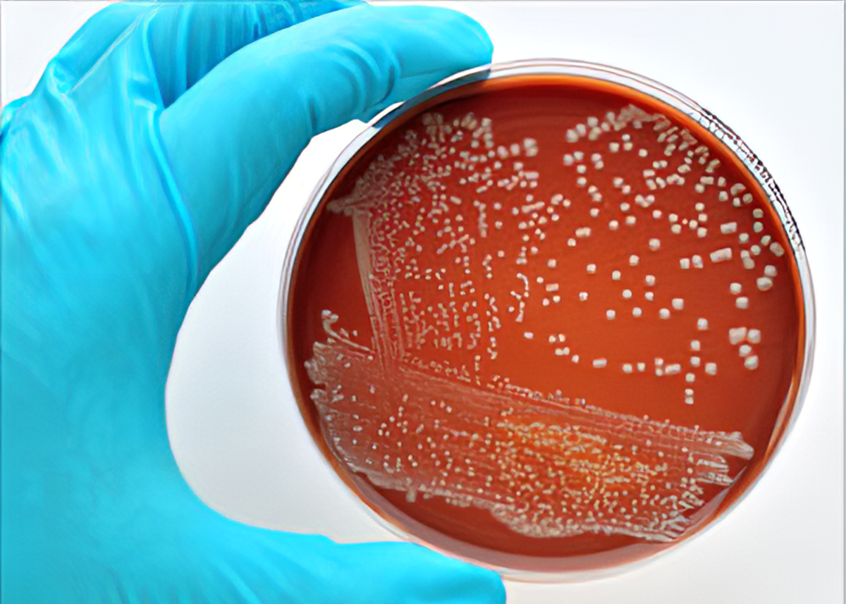 Vi khuẩn E.Coli không 'lành' như bạn vẫn nghĩ và 5 chìa khóa phòng ngộ độc thực phẩm